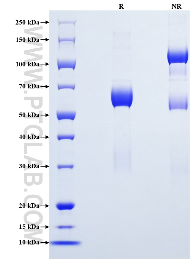 Purity of Recombinant Human CD207 was determined by SDS-PAGE. The protein was resolved in an SDS-PAGE in reducing (R) and non-reducing (NR) conditions and stained using Coomassie blue.