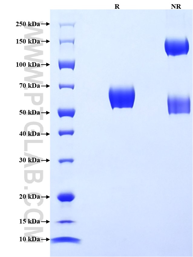 Purity of Recombinant Human PROCR was determined by SDS-PAGE. The protein was resolved in an SDS-PAGE in reducing (R) and non-reducing (NR) conditions and stained using Coomassie blue.