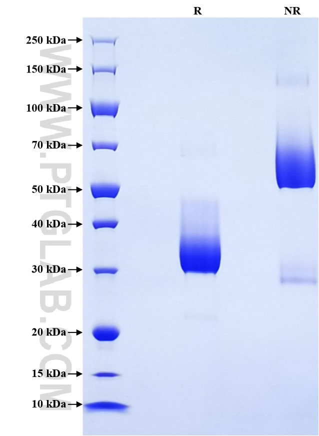 Purity of Recombinant Human CCR6 was determined by SDS-PAGE. The protein was resolved in an SDS-PAGE in reducing (R) and non-reducing (NR) conditions and stained using Coomassie blue.