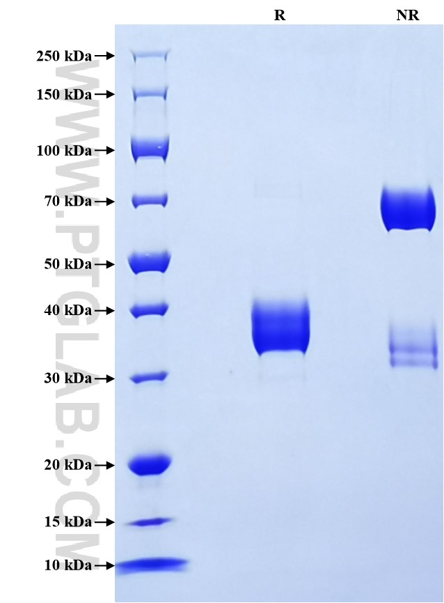 Purity of Recombinant Human TWEAKR was determined by SDS-PAGE. The protein was resolved in an SDS-PAGE in reducing (R) and non-reducing (NR) conditions and stained using Coomassie blue. Purity of Recombinant Human TWEAKR was determined by SDS-PAGE. The protein was resolved in an SDS-PAGE in reducing (R) and non-reducing (NR) conditions and stained using Coomassie blue.