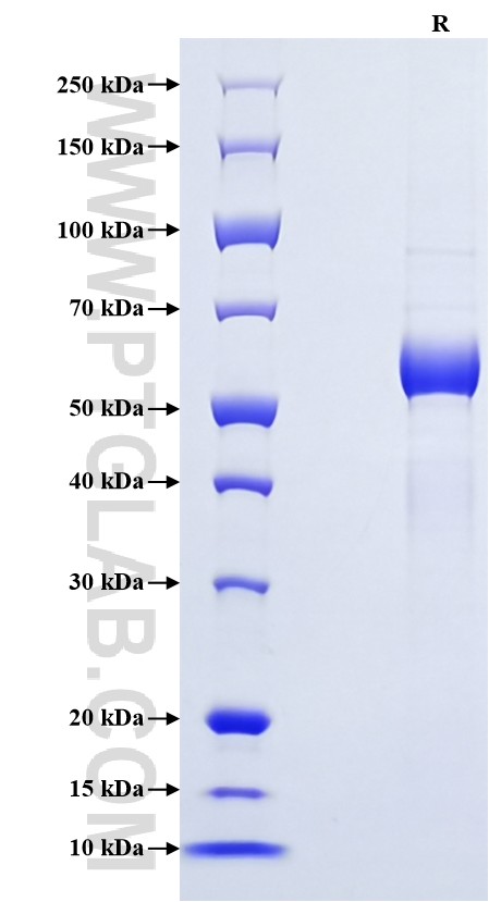 Purity of Recombinant Human C1QA was determined by SDS-PAGE. The protein was resolved in an SDS-PAGE in reducing (R) conditions and stained using Coomassie blue. Purity of Recombinant Human C1QA was determined by SDS-PAGE. The protein was resolved in an SDS-PAGE in reducing (R) conditions and stained using Coomassie blue.