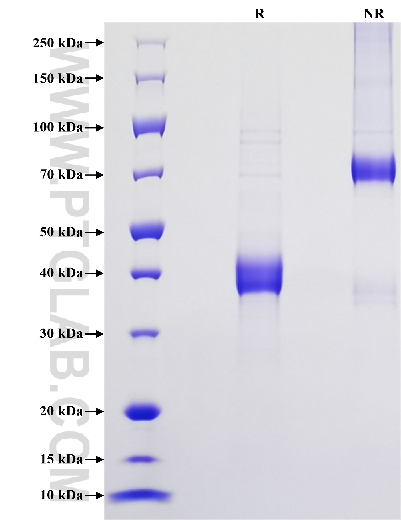 Purity of Recombinant Mouse Ccl11 was determined by SDS-PAGE. The protein was resolved in an SDS-PAGE in reducing (R) and non-reducing (NR) conditions and stained using Coomassie blue.