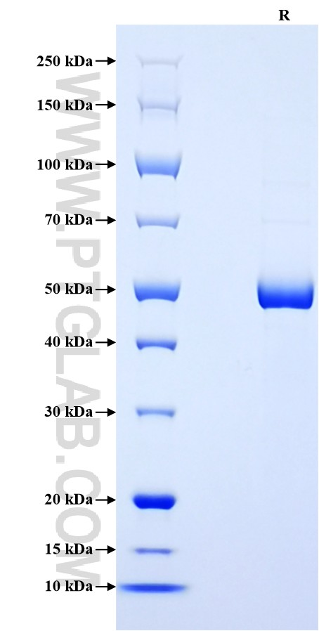 Purity of Recombinant Human C-Reactive Protein was determined by SDS-PAGE. The protein was resolved in an SDS-PAGE in reducing (R) conditions and stained using Coomassie blue.