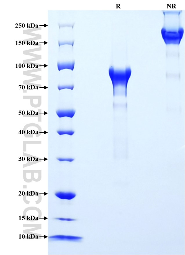 Purity of Recombinant Human Carbonic Anhydrase IX was determined by SDS-PAGE. The protein was resolved in an SDS-PAGE in reducing (R) and non-reducing (NR) conditions and stained using Coomassie blue.