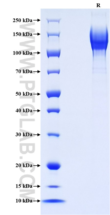 Purity of Recombinant Human CD45 was determined by SDS-PAGE. The protein was resolved in an SDS-PAGE in reducing (R) conditions and stained using Coomassie blue. Purity of Recombinant Human CD45 was determined by SDS-PAGE. The protein was resolved in an SDS-PAGE in reducing (R) conditions and stained using Coomassie blue.