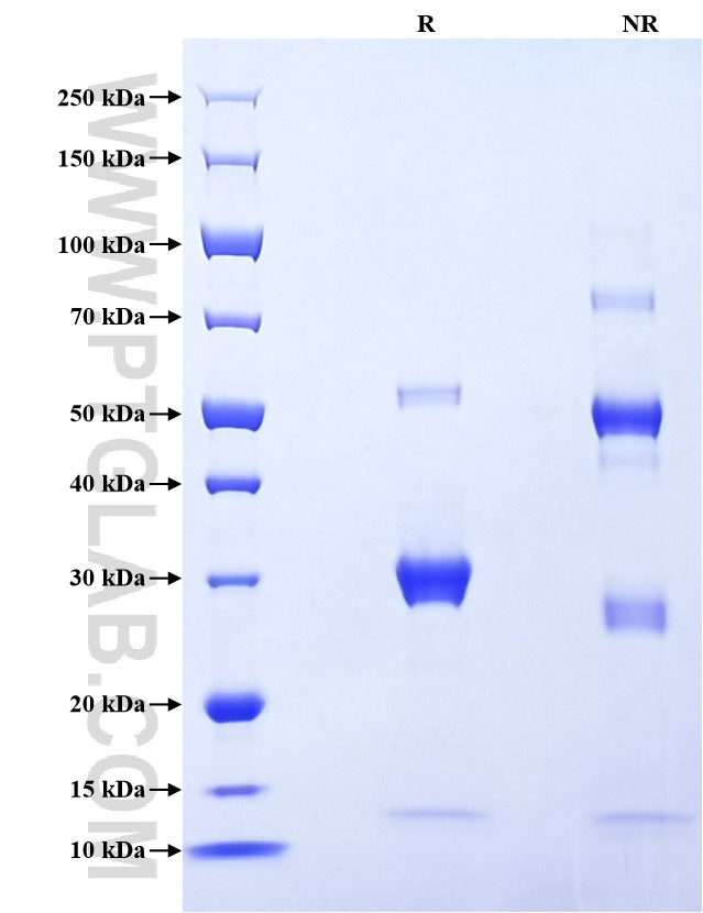 Purity of Recombinant Human KLK14 was determined by SDS-PAGE. The protein was resolved in an SDS-PAGE in reducing (R) and non-reducing (NR) conditions and stained using Coomassie blue.