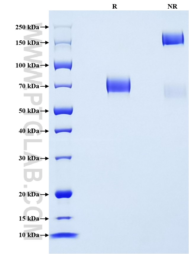 Purity of Recombinant Mouse OLR1 was determined by SDS-PAGE. The protein was resolved in an SDS-PAGE in reducing (R) and non-reducing (NR) conditions and stained using Coomassie blue.