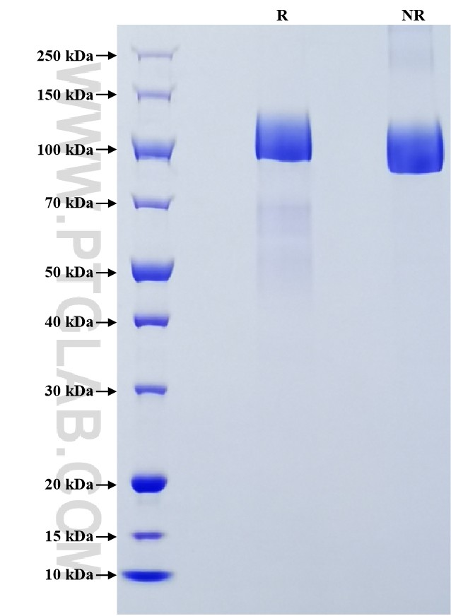 Purity of Recombinant Human FLT4 was determined by SDS-PAGE. The protein was resolved in an SDS-PAGE in reducing (R) and non-reducing (NR) conditions and stained using Coomassie blue. Purity of Recombinant Human FLT4 was determined by SDS-PAGE. The protein was resolved in an SDS-PAGE in reducing (R) and non-reducing (NR) conditions and stained using Coomassie blue.
