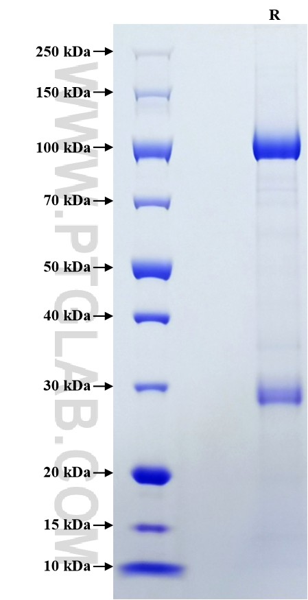 Purity of Recombinant Human ADAMTS13 was determined by SDS-PAGE. The protein was resolved in an SDS-PAGE in reducing (R)  conditions and stained using Coomassie blue.