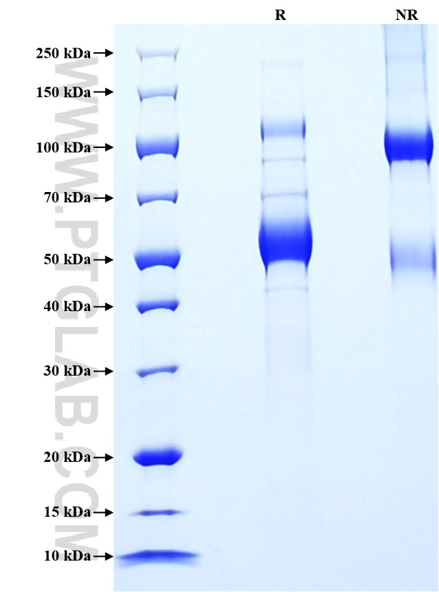 Purity of Recombinant Human TNFSF11 was determined by SDS-PAGE. The protein was resolved in an SDS-PAGE in reducing (R) and non-reducing (NR) conditions and stained using Coomassie blue. Purity of Recombinant Human TNFSF11 was determined by SDS-PAGE. The protein was resolved in an SDS-PAGE in reducing (R) and non-reducing (NR) conditions and stained using Coomassie blue.