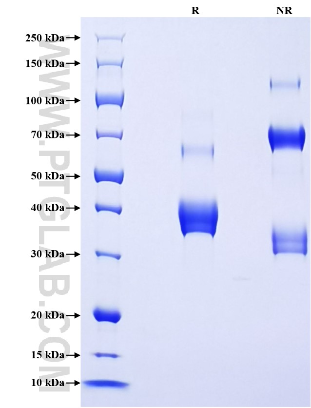 Purity of Recombinant Human CXCL1 was determined by SDS-PAGE. The protein was resolved in an SDS-PAGE in reducing (R) and non-reducing (NR) conditions and stained using Coomassie blue.