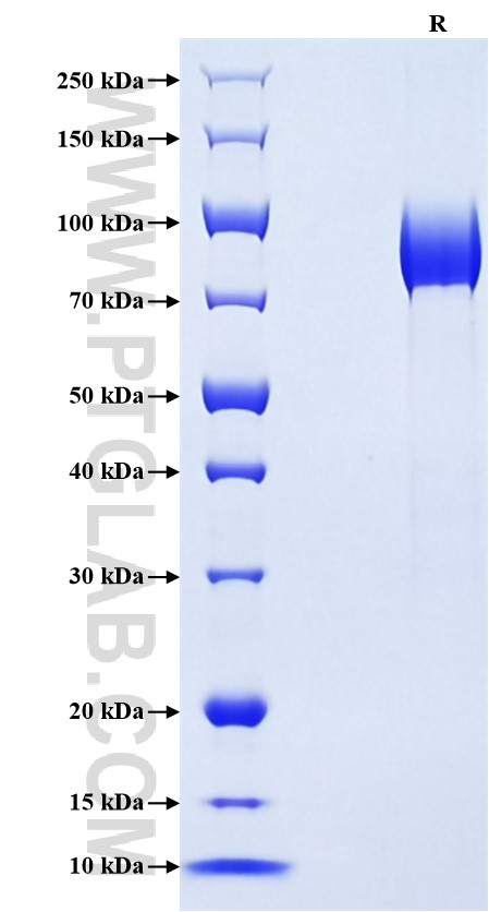 Purity of Recombinant Human CD204 was determined by SDS-PAGE. The protein was resolved in an SDS-PAGE in reducing (R) conditions and stained using Coomassie blue.
