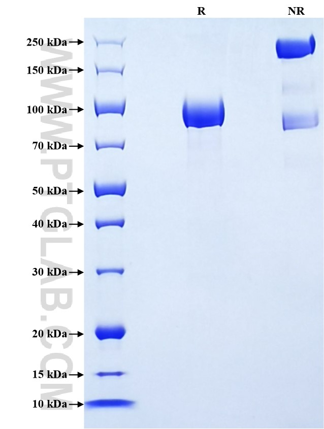Purity of Recombinant Human BCAM was determined by SDS-PAGE. The protein was resolved in an SDS-PAGE in reducing (R) and non-reducing (NR) conditions and stained using Coomassie blue. Purity of Recombinant Human BCAM was determined by SDS-PAGE. The protein was resolved in an SDS-PAGE in reducing (R) and non-reducing (NR) conditions and stained using Coomassie blue.