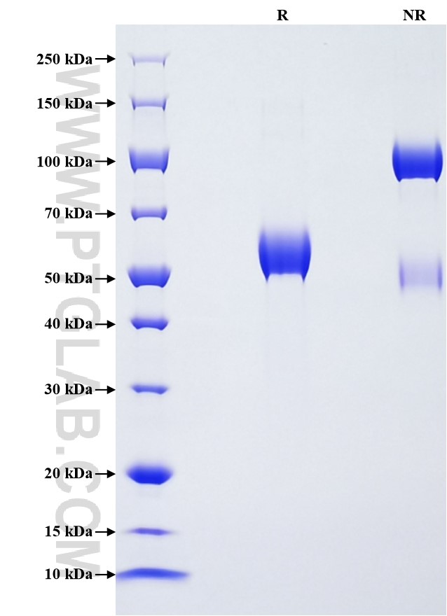 Purity of Recombinant Human CLEC4C was determined by SDS-PAGE. The protein was resolved in an SDS-PAGE in reducing (R) and non-reducing (NR) conditions and stained using Coomassie blue. Purity of Recombinant Human CLEC4C was determined by SDS-PAGE. The protein was resolved in an SDS-PAGE in reducing (R) and non-reducing (NR) conditions and stained using Coomassie blue.