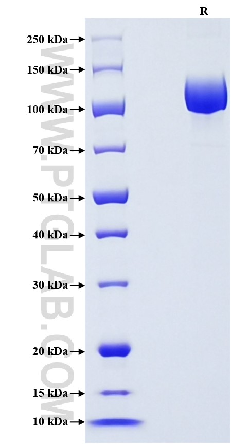 Purity of Recombinant Human Neprilysin was determined by SDS-PAGE. The protein was resolved in an SDS-PAGE in reducing (R) conditions and stained using Coomassie blue. Purity of Recombinant Human Neprilysin was determined by SDS-PAGE. The protein was resolved in an SDS-PAGE in reducing (R) conditions and stained using Coomassie blue.