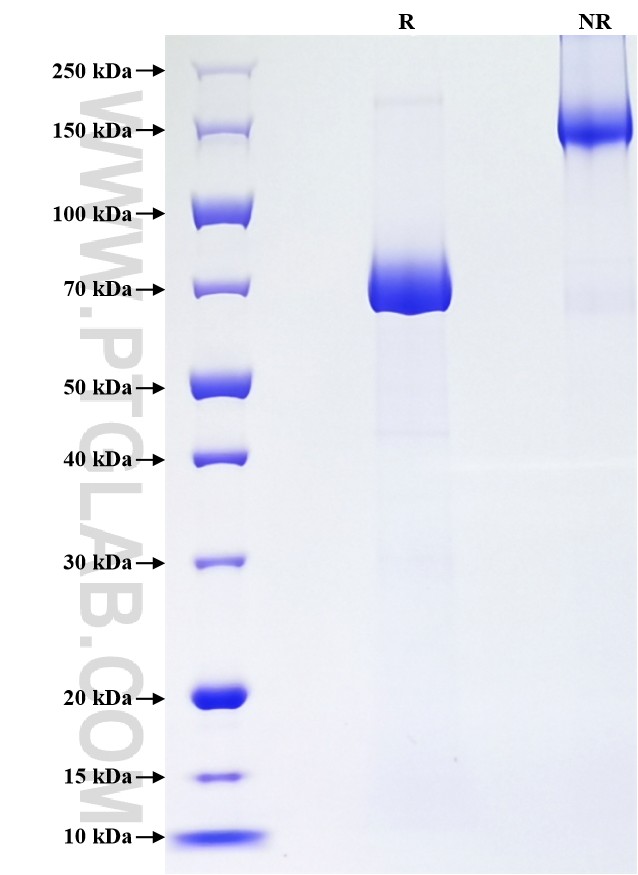 Purity of Recombinant Human IL-13RA2 was determined by SDS-PAGE. The protein was resolved in an SDS-PAGE in reducing (R) and non-reducing (NR) conditions and stained using Coomassie blue.