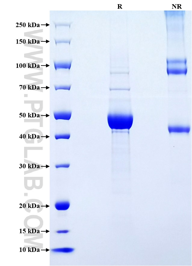 Purity of Recombinant Rat IL-1 beta was determined by SDS-PAGE. The protein was resolved in an SDS-PAGE in reducing (R) and non-reducing (NR) conditions and stained using Coomassie blue. Purity of Recombinant Rat IL-1 beta was determined by SDS-PAGE. The protein was resolved in an SDS-PAGE in reducing (R) and non-reducing (NR) conditions and stained using Coomassie blue.