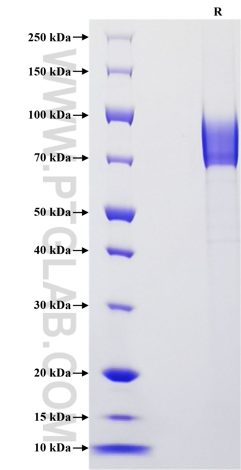 Purity of Recombinant Mouse IL-17RA was determined by SDS-PAGE. The protein was resolved in an SDS-PAGE in reducing (R) conditions and stained using Coomassie blue.