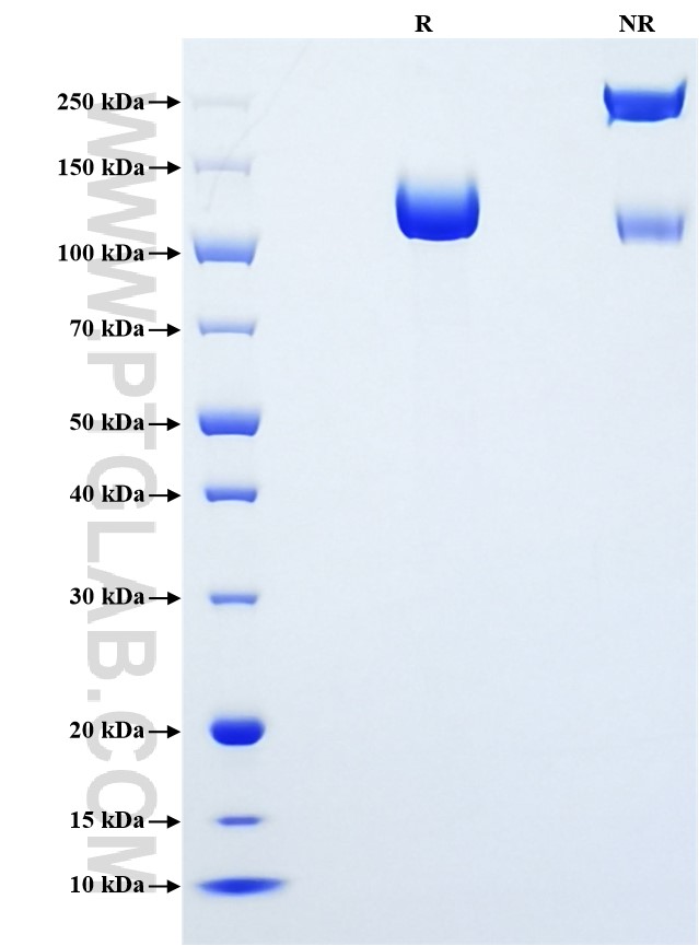Purity of Recombinant Mouse CD22 was determined by SDS-PAGE. The protein was resolved in an SDS-PAGE in reducing (R) and non-reducing (NR) conditions and stained using Coomassie blue. Purity of Recombinant Mouse CD22 was determined by SDS-PAGE. The protein was resolved in an SDS-PAGE in reducing (R) and non-reducing (NR) conditions and stained using Coomassie blue.