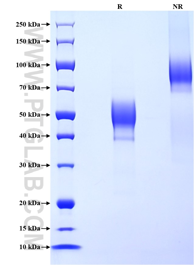 Purity of Recombinant Human IGLV3-21 was determined by SDS-PAGE. The protein was resolved in an SDS-PAGE in reducing (R) and non-reducing (NR) conditions and stained using Coomassie blue. Purity of Recombinant Human IGLV3-21 was determined by SDS-PAGE. The protein was resolved in an SDS-PAGE in reducing (R) and non-reducing (NR) conditions and stained using Coomassie blue.