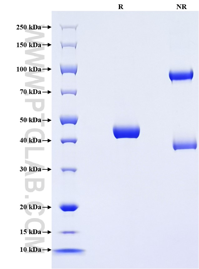 Purity of Recombinant Human IFNA1 was determined by SDS-PAGE. The protein was resolved in an SDS-PAGE in reducing (R) and non-reducing (NR) conditions and stained using Coomassie blue. Purity of Recombinant Human IFNA1 was determined by SDS-PAGE. The protein was resolved in an SDS-PAGE in reducing (R) and non-reducing (NR) conditions and stained using Coomassie blue.