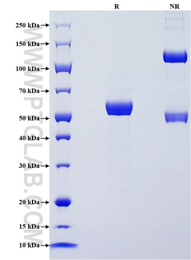 Purity of Recombinant Human EPOR was determined by SDS-PAGE. The protein was resolved in an SDS-PAGE in reducing (R) and non-reducing (NR) conditions and stained using Coomassie blue.