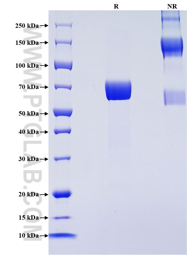 Purity of Recombinant Rat FSTL1 was determined by SDS-PAGE. The protein was resolved in an SDS-PAGE in reducing (R) and non-reducing (NR) conditions and stained using Coomassie blue.