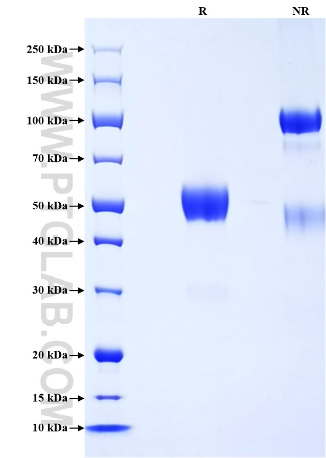 Purity of Recombinant Rat IL-9 was determined by SDS-PAGE. The protein was resolved in an SDS-PAGE in reducing (R) and non-reducing (NR) conditions and stained using Coomassie blue. Purity of Recombinant Rat IL-9 was determined by SDS-PAGE. The protein was resolved in an SDS-PAGE in reducing (R) and non-reducing (NR) conditions and stained using Coomassie blue.