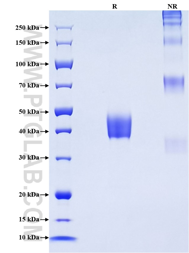 Purity of Recombinant Mouse Ly6g was determined by SDS-PAGE. The protein was resolved in an SDS-PAGE in reducing (R) and non-reducing (NR) conditions and stained using Coomassie blue.