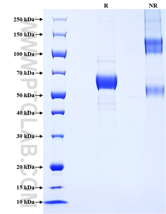 Purity of Recombinant Human CRLF2 was determined by SDS-PAGE. The protein was resolved in an SDS-PAGE in reducing (R) and non-reducing (NR) conditions and stained using Coomassie blue.