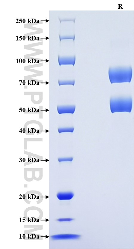 Purity of Recombinant Human SUSD2 was determined by SDS-PAGE. The protein was resolved in an SDS-PAGE in reducing (R) condition and stained using Coomassie blue.