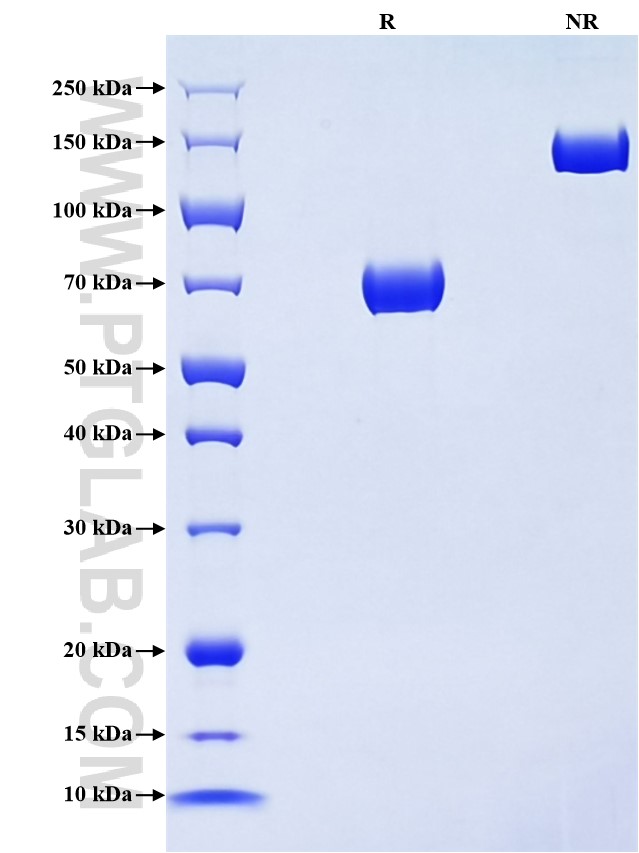 Purity of Recombinant Human Siglec-8 was determined by SDS-PAGE. The protein was resolved in an SDS-PAGE in reducing (R) and non-reducing (NR) conditions and stained using Coomassie blue.