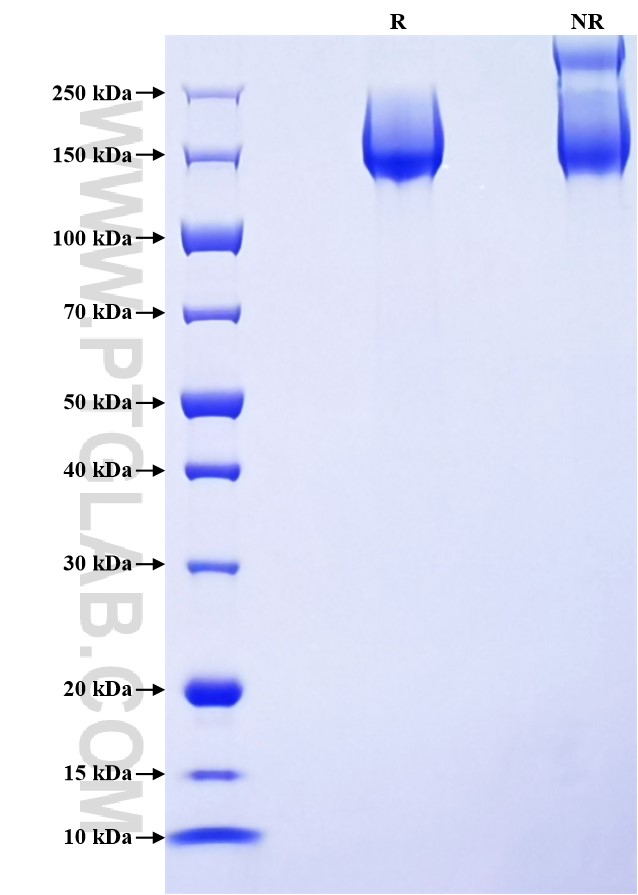 Purity of Recombinant Mouse PTPRJ/CD148 was determined by SDS-PAGE. The protein was resolved in an SDS-PAGE in reducing (R) and non-reducing (NR) conditions and stained using Coomassie blue.