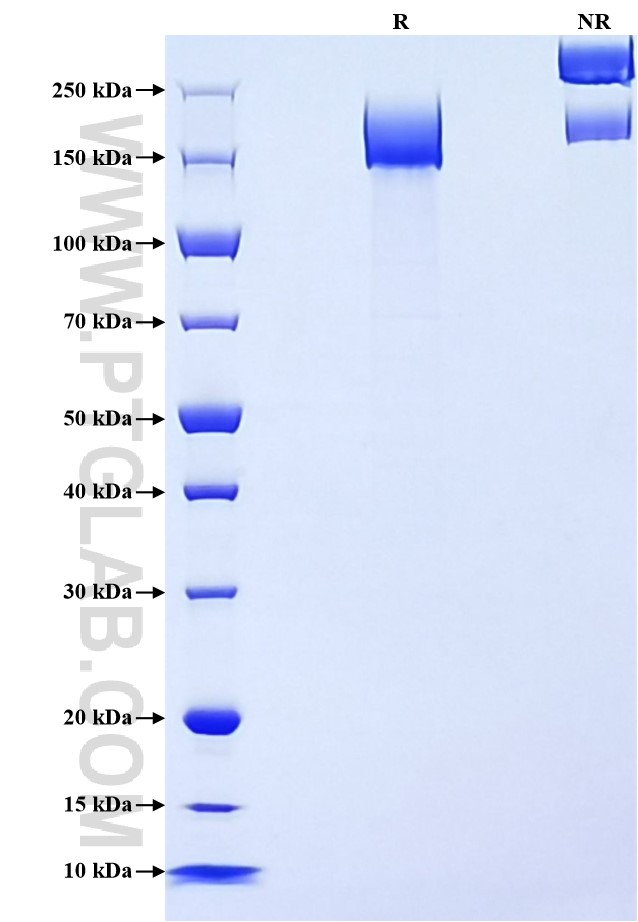Purity of Recombinant Human MRC2 was determined by SDS-PAGE. The protein was resolved in an SDS-PAGE in reducing (R) and non-reducing (NR) conditions and stained using Coomassie blue. Purity of Recombinant Human MRC2 was determined by SDS-PAGE. The protein was resolved in an SDS-PAGE in reducing (R) and non-reducing (NR) conditions and stained using Coomassie blue.