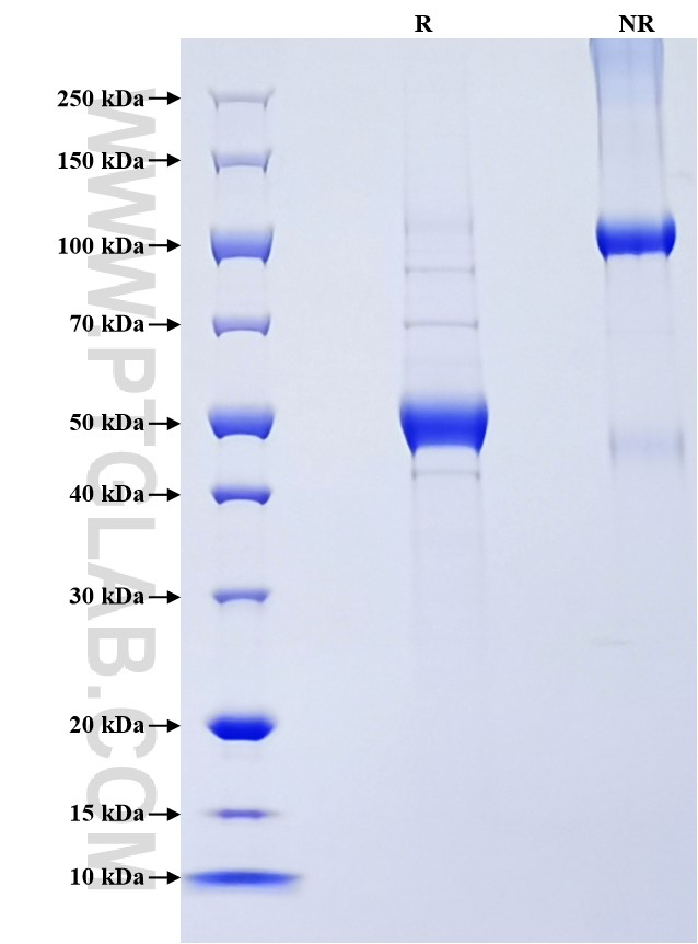Purity of Recombinant Mouse LIGHT was determined by SDS-PAGE. The protein was resolved in an SDS-PAGE in reducing (R) and non-reducing (NR) conditions and stained using Coomassie blue. Purity of Recombinant Mouse LIGHT was determined by SDS-PAGE. The protein was resolved in an SDS-PAGE in reducing (R) and non-reducing (NR) conditions and stained using Coomassie blue.