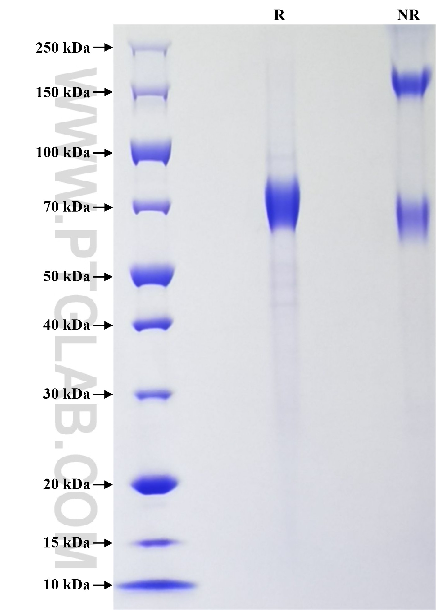 Purity of Recombinant Human ART4 was determined by SDS-PAGE. The protein was resolved in an SDS-PAGE in reducing (R) and non-reducing (NR) conditions and stained using Coomassie blue.
