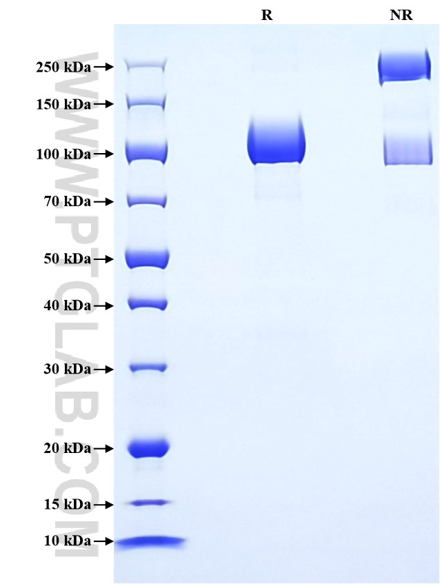 Purity of Recombinant Mouse CD146 was determined by SDS-PAGE. The protein was resolved in an SDS-PAGE in reducing (R) and non-reducing (NR) conditions and stained using Coomassie blue.