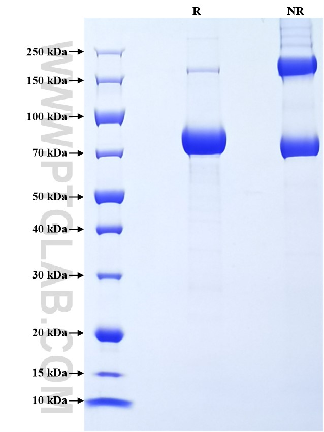 Purity of Recombinant Human LILRA3 was determined by SDS-PAGE. The protein was resolved in an SDS-PAGE in reducing (R) and non-reducing (NR) conditions and stained using Coomassie blue. Purity of Recombinant Human LILRA3 was determined by SDS-PAGE. The protein was resolved in an SDS-PAGE in reducing (R) and non-reducing (NR) conditions and stained using Coomassie blue.