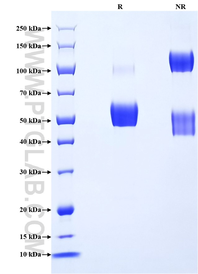 Purity of Recombinant Mouse Dectin-1 was determined by SDS-PAGE. The protein was resolved in an SDS-PAGE in reducing (R) and non-reducing (NR) conditions and stained using Coomassie blue. Purity of Recombinant Mouse Dectin-1 was determined by SDS-PAGE. The protein was resolved in an SDS-PAGE in reducing (R) and non-reducing (NR) conditions and stained using Coomassie blue.