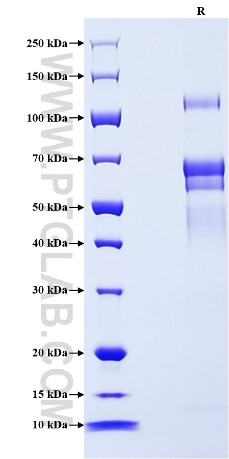 Purity of Recombinant Mouse Complement factor I was determined by SDS-PAGE. The protein was resolved in an SDS-PAGE in reducing (R) conditions and stained using Coomassie blue. Purity of Recombinant Mouse Complement factor I was determined by SDS-PAGE. The protein was resolved in an SDS-PAGE in reducing (R) conditions and stained using Coomassie blue.
