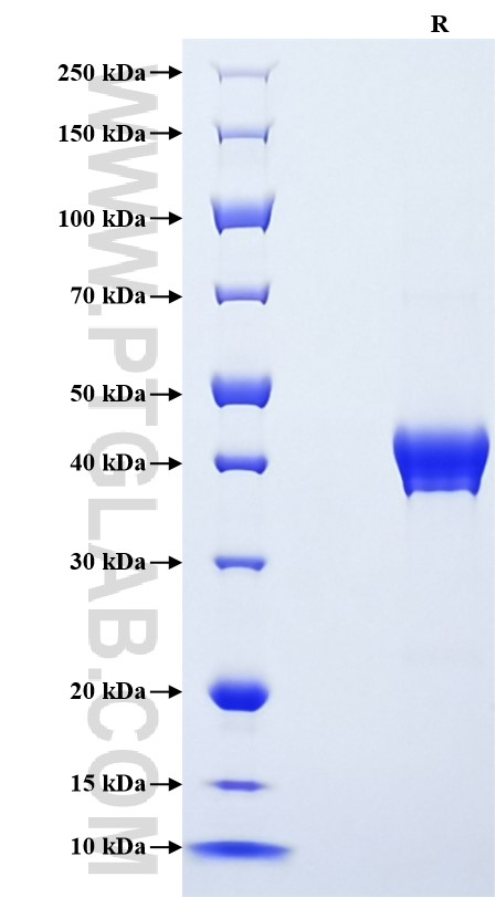 Purity of Recombinant Human NRN1L was determined by SDS-PAGE. The protein was resolved in an SDS-PAGE in reducing (R) conditions and stained using Coomassie blue.