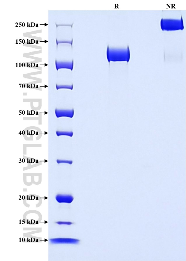 Purity of Recombinant Mouse SEMA5A was determined by SDS-PAGE. The protein was resolved in an SDS-PAGE in reducing (R) and non-reducing (NR) conditions and stained using Coomassie blue.