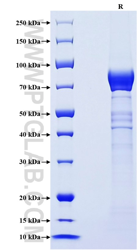 Purity of Recombinant Mouse CRTAM was determined by SDS-PAGE. The protein was resolved in an SDS-PAGE in reducing (R) condition and stained using Coomassie blue. Purity of Recombinant Mouse CRTAM was determined by SDS-PAGE. The protein was resolved in an SDS-PAGE in reducing (R) condition and stained using Coomassie blue.