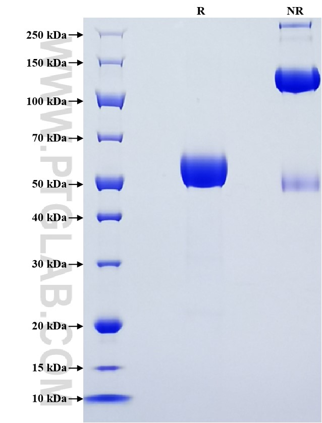 Purity of Recombinant Mouse MGL1 was determined by SDS-PAGE. The protein was resolved in an SDS-PAGE in reducing (R) and non-reducing (NR) conditions and stained using Coomassie blue. Purity of Recombinant Mouse MGL1 was determined by SDS-PAGE. The protein was resolved in an SDS-PAGE in reducing (R) and non-reducing (NR) conditions and stained using Coomassie blue.