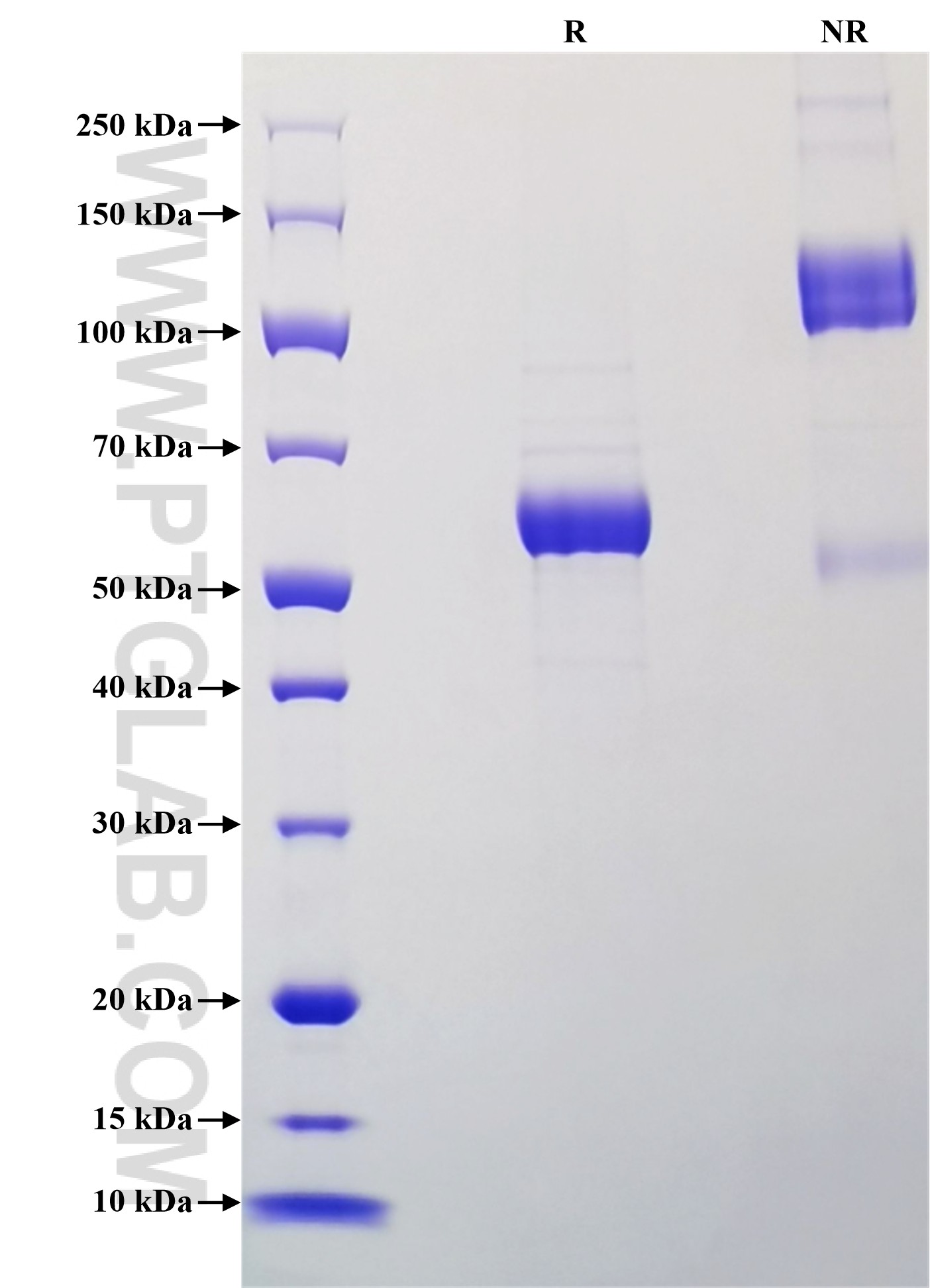 Purity of Recombinant Mouse CD72 was determined by SDS-PAGE. The protein was resolved in an SDS-PAGE in reducing (R) and non-reducing (NR) conditions and stained using Coomassie blue. Purity of Recombinant Mouse CD72 was determined by SDS-PAGE. The protein was resolved in an SDS-PAGE in reducing (R) and non-reducing (NR) conditions and stained using Coomassie blue.