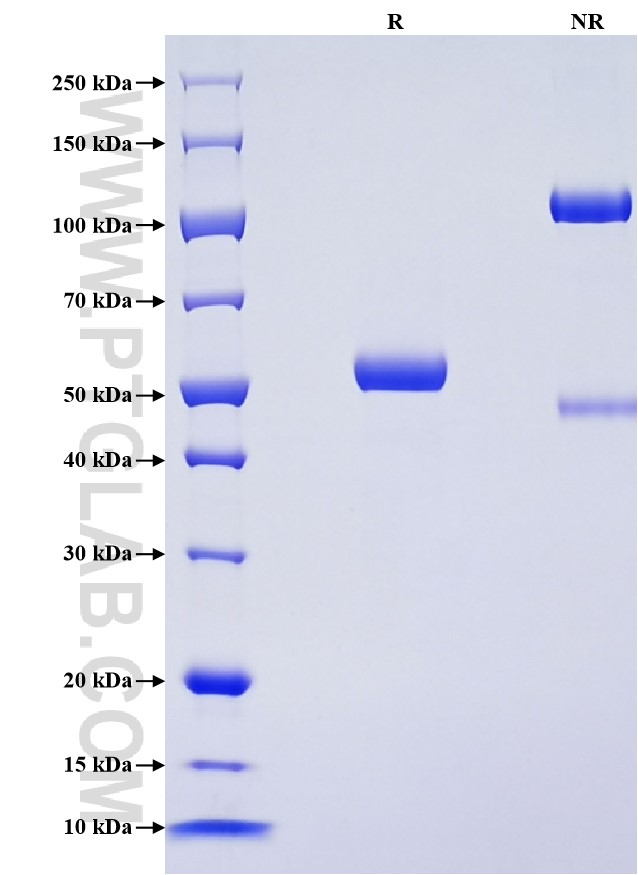 Purity of Recombinant Human FCGR2A was determined by SDS-PAGE. The protein was resolved in an SDS-PAGE in reducing (R) and non-reducing (NR) conditions and stained using Coomassie blue. Purity of Recombinant Human FCGR2A was determined by SDS-PAGE. The protein was resolved in an SDS-PAGE in reducing (R) and non-reducing (NR) conditions and stained using Coomassie blue.