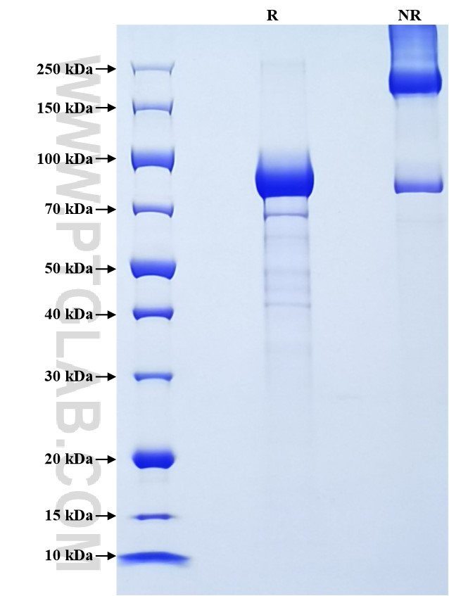 Purity of Recombinant Mouse ALPL was determined by SDS-PAGE. The protein was resolved in an SDS-PAGE in reducing (R) and non-reducing (NR) conditions and stained using Coomassie blue. Purity of Recombinant Mouse ALPL was determined by SDS-PAGE. The protein was resolved in an SDS-PAGE in reducing (R) and non-reducing (NR) conditions and stained using Coomassie blue.