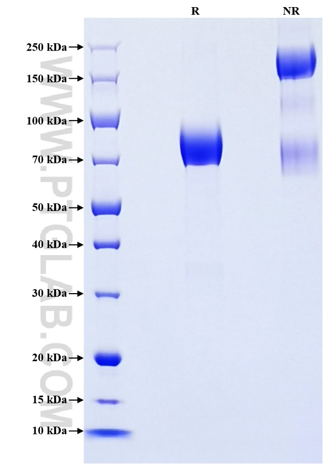 Purity of Recombinant Human TNFRSF21 was determined by SDS-PAGE. The protein was resolved in an SDS-PAGE in reducing (R) and non-reducing (NR) conditions and stained using Coomassie blue. Purity of Recombinant Human TNFRSF21 was determined by SDS-PAGE. The protein was resolved in an SDS-PAGE in reducing (R) and non-reducing (NR) conditions and stained using Coomassie blue.