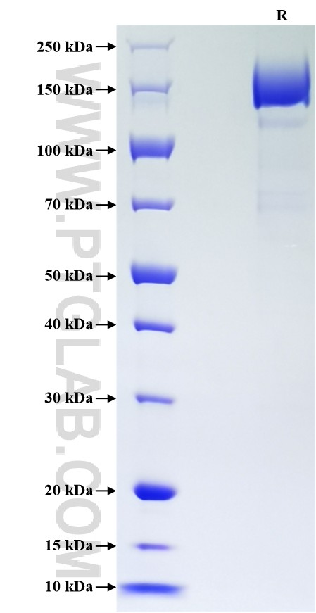 Purity of Recombinant Human PLXNC1 was determined by SDS-PAGE. The protein was resolved in an SDS-PAGE in reducing (R) conditions and stained using Coomassie blue.
