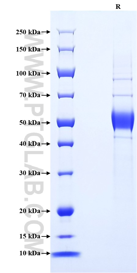 Purity of Recombinant Mouse CD37 was determined by SDS-PAGE. The protein was resolved in an SDS-PAGE in reducing (R) conditions and stained using Coomassie blue. Purity of Recombinant Mouse CD37 was determined by SDS-PAGE. The protein was resolved in an SDS-PAGE in reducing (R) conditions and stained using Coomassie blue.